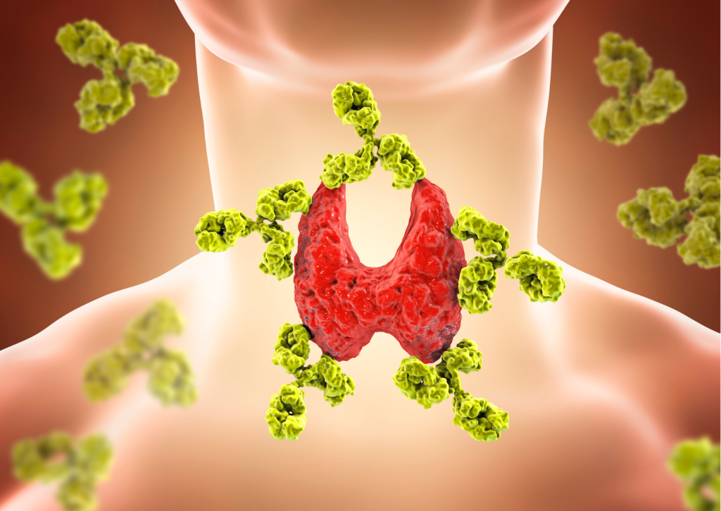 Enfermedades autoinmunes Fit and Friends